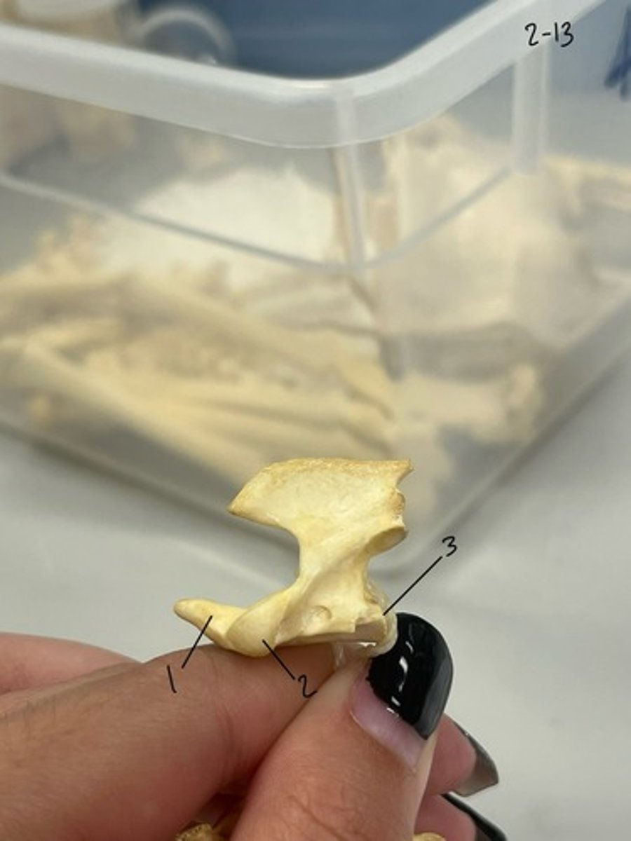 <p>Entire structure?</p>