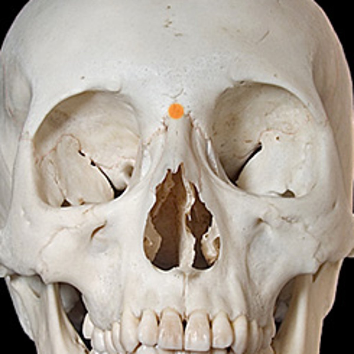 <p>Bridge of the nose, between the eyes.</p>