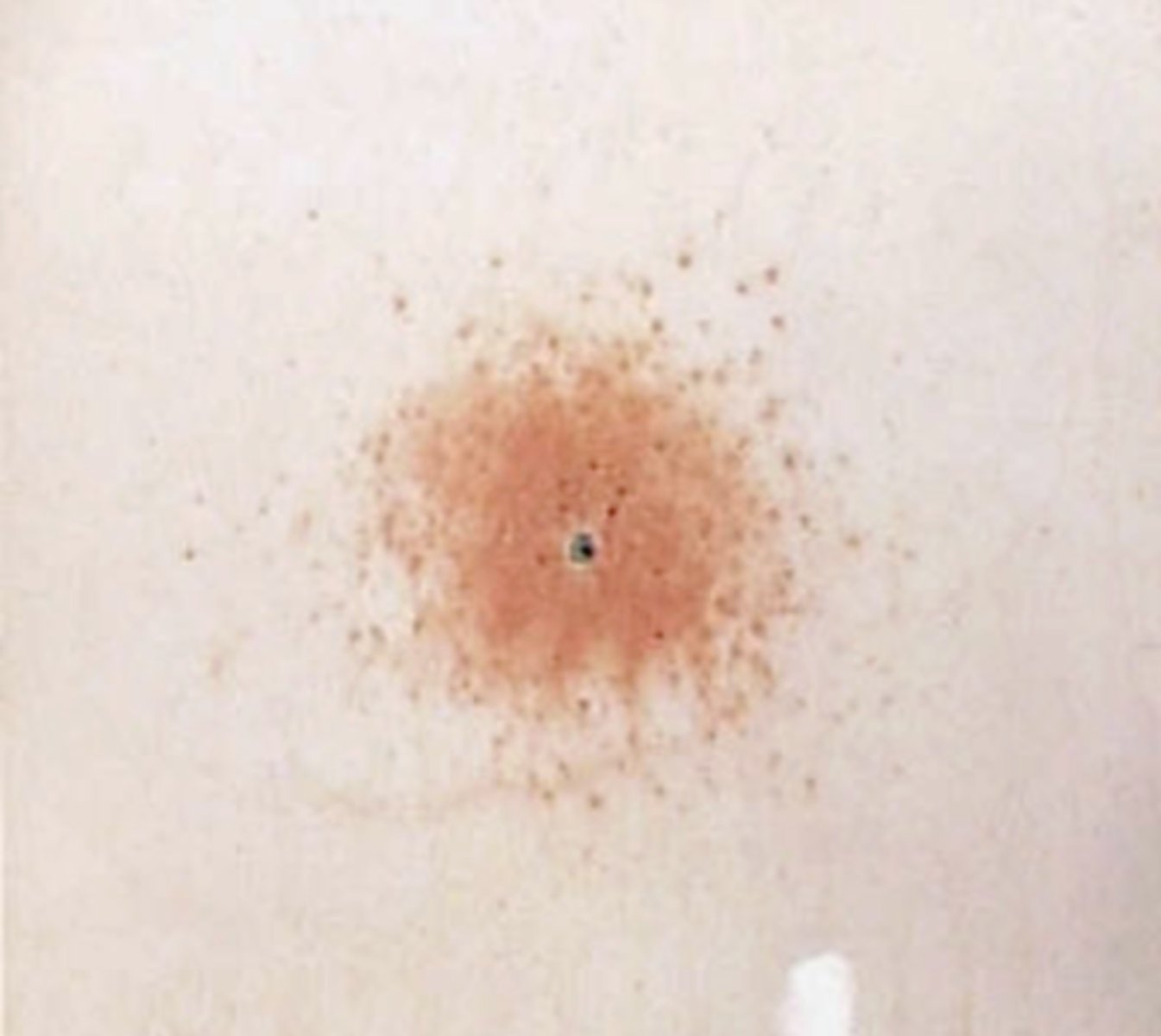 <p>-Detects nitrites, a product of combustion</p><p>-Performed first (does not interfere with later tests)</p><p>-Use iron to transfer material from clothing to sheet of paper, test paper with spray chemical</p><p>-Results in orange specks</p>