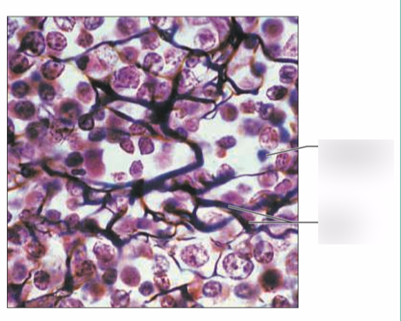 <p><strong>What is a picture example of reticular connective tissue?</strong></p>