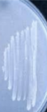 <p>Is this a negative or positive Lipid hydrolysis (Sprit blue agar) test?</p>