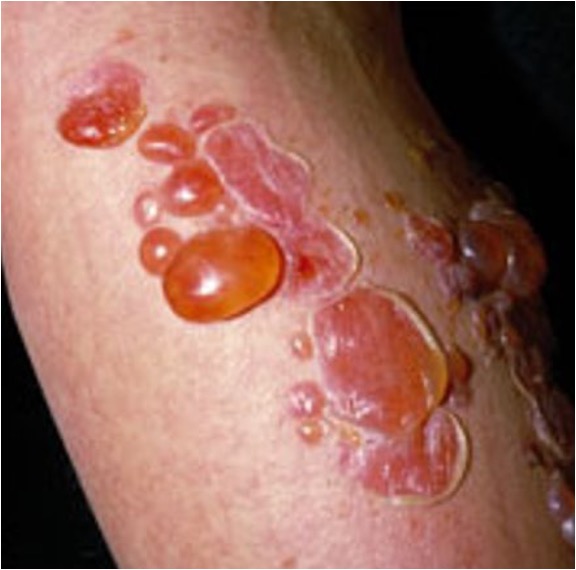<p>what condition is this?</p>