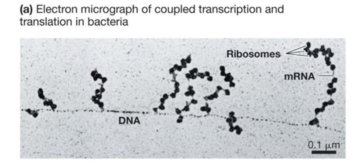 <p>Translation occurs in the cytoplasm and can be coupled with transcription due to the absence of a nuclear envelope.</p>