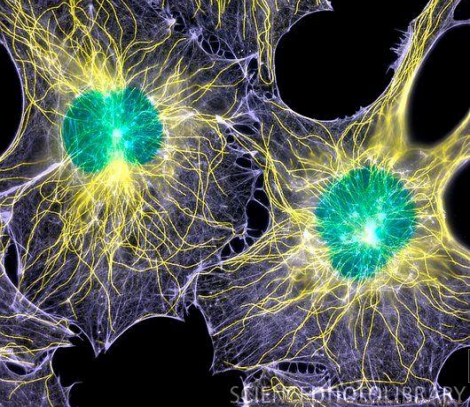 Based on the picture, where is the nuclei and where is the cytoskeleton