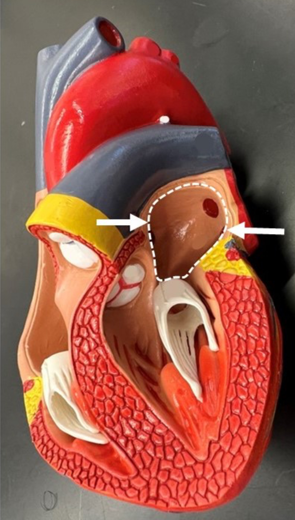 term image