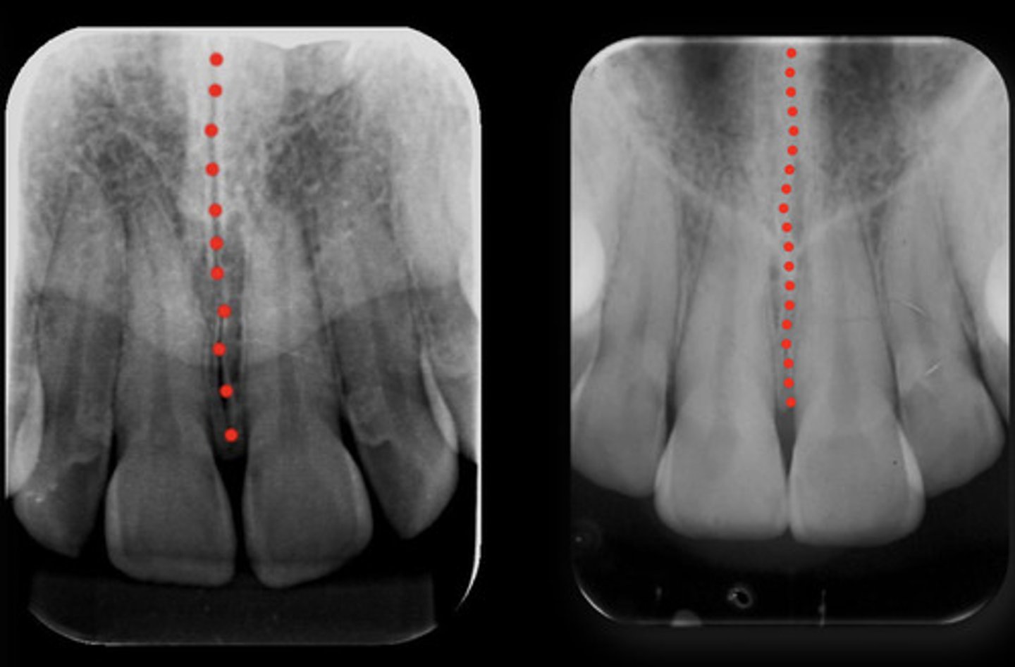 <p>What is the red dotted line representing?</p>
