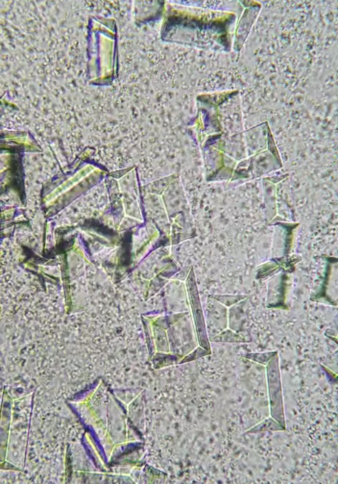 Triple phosphate crystals