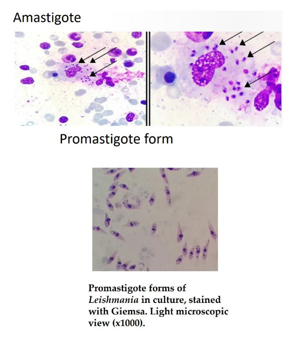 <p>Amastigote</p><p>Promastigote</p>