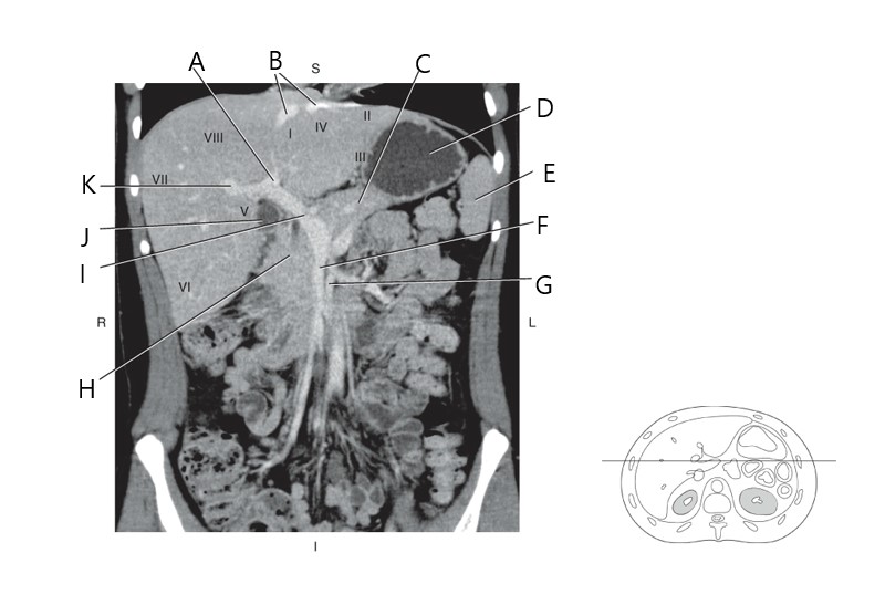 <p>A</p>