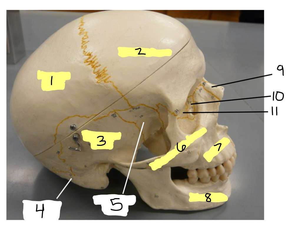 <p>LATERAL VIEW - 5</p>