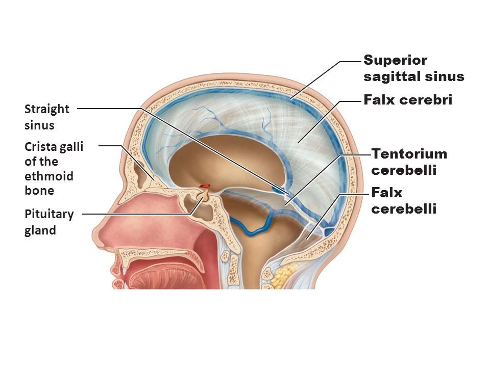 <p>an invagination of the meningeal layer of the dura mater that separates the occipital and temporal lobes of the cerebral hemispheres from the cerebellum and brainstem</p>