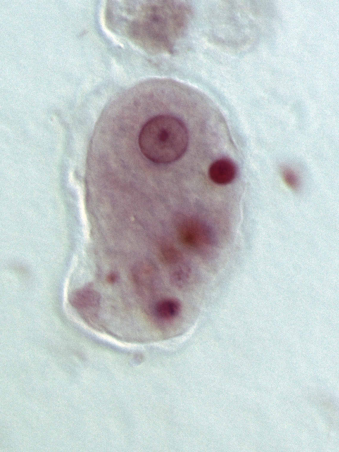 term image