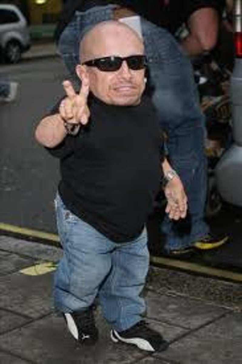 <p>Hyposecretion of growth hormone in children, resulting in slow long bone growth.</p>