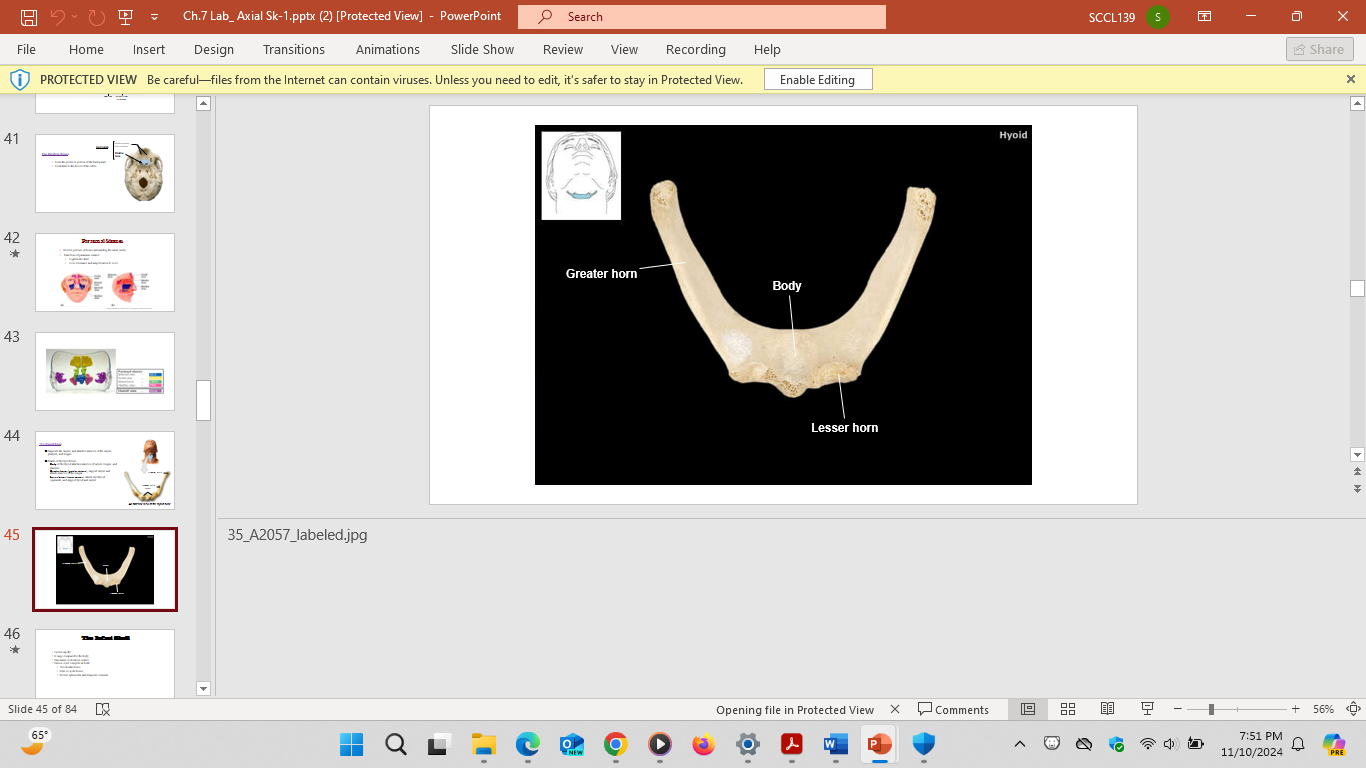 <p>-Body (attaches to muscles of larynx and tongue)</p><p>-Greater cornua (support larynx, tongue and pharynx)</p><p>-Lesser Cronua (attach stylohyoid ligaments and support hyoid and larynx)</p>