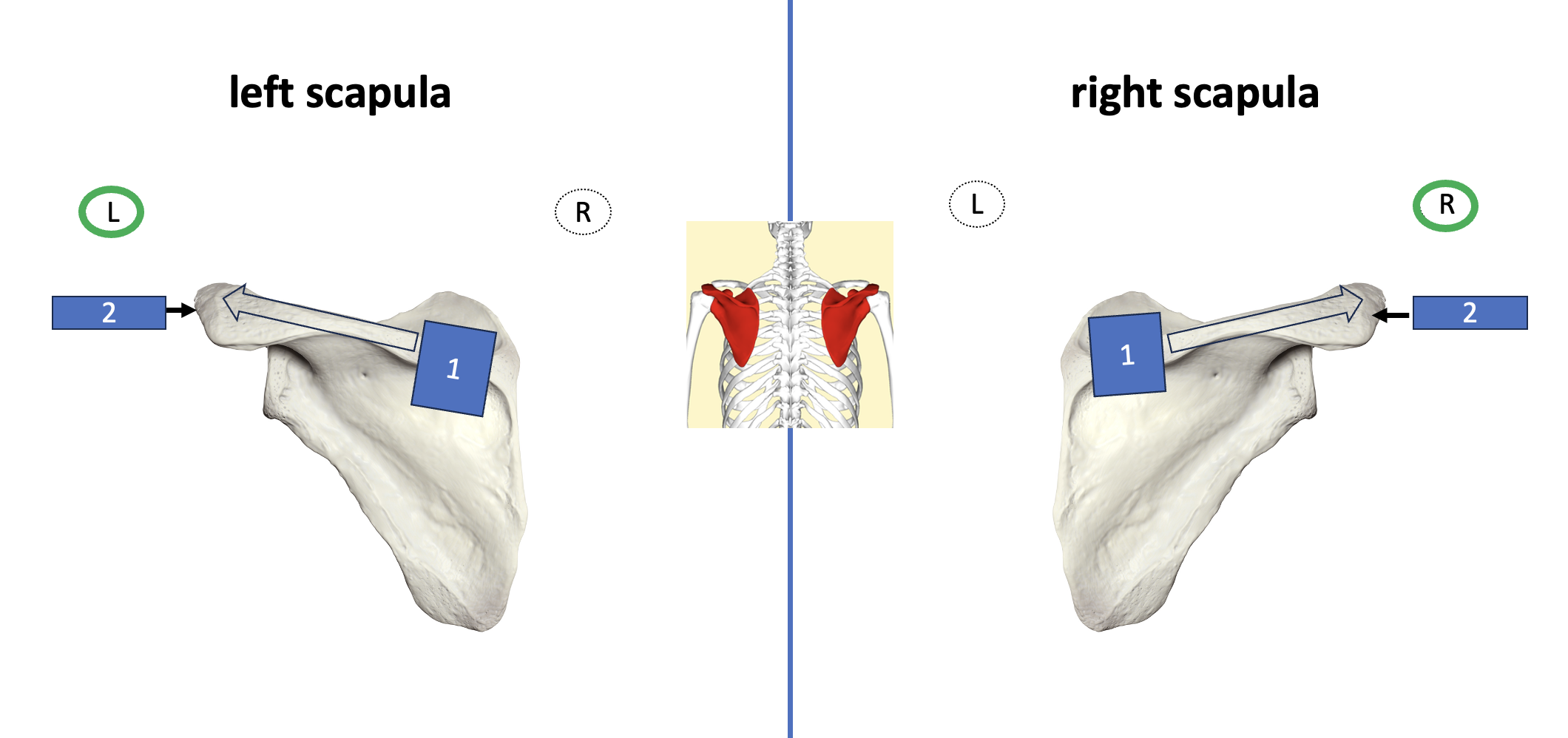 <p>spine </p>