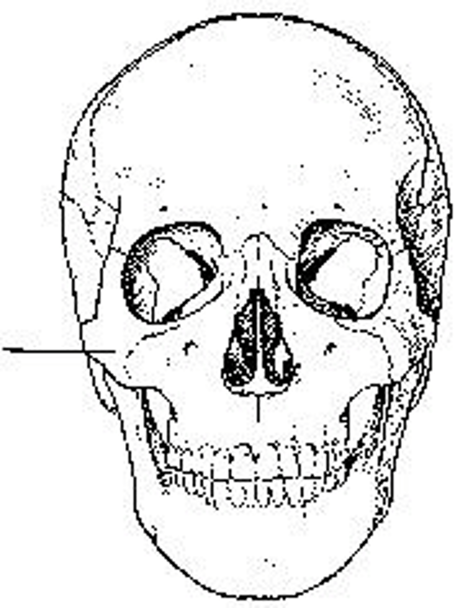 <p>What bone is identified?</p>