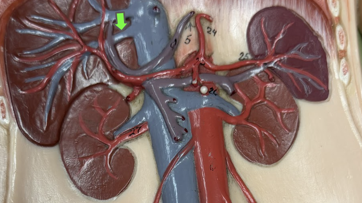 <p>Hepatic vein </p>