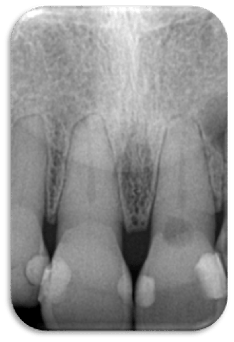 <p>ID the problem:</p>