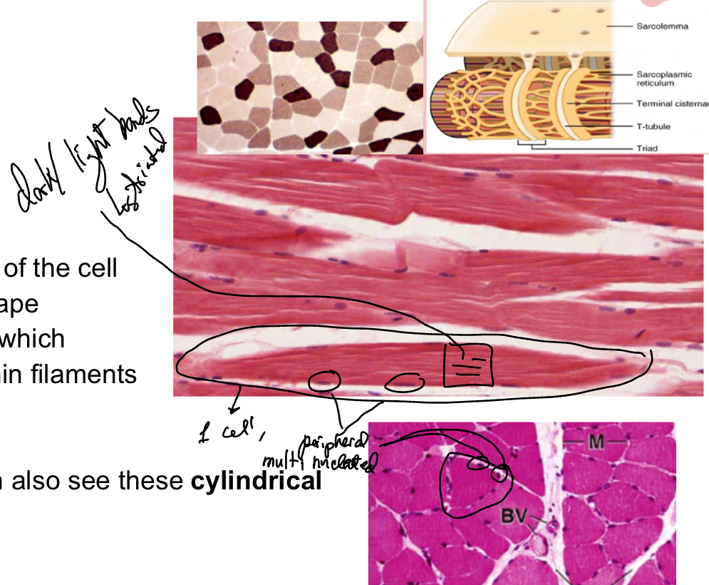 <ul><li><p>multinucleated, on periphery</p></li><li><p>Long large cells</p></li><li><p>Basement membrane known as sarcolemma, forms deep invagination known as T-tubules. T-tubules together with terminal cisternae (end of sarcoplasmic reticulum) to form triads. Cytoplasm known as sarcoplasm.</p></li><li><p>Striations which corresponds to myofibrils and thin filaments</p></li><li><p>3 different cell types ahve different metabolic compnents, shown by differences in staining:</p><ul><li><p>Red fibers type I: abudnant in myogobin, slow contraction, abundant mitochondria, strong oxidative capcity, more vascularized, thinner less fibers</p></li><li><p>White fibers (type Ilb): fast contraction but fatigue easily, low myogobin, few mitochondria, fast anaerobic glycolysis metabolism, larger and more myofibrils, less vascularized,</p></li><li><p>Intermediate fibers (type Ila)</p></li></ul></li></ul><p></p>