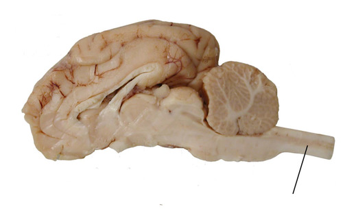 <p>Spinal Cord</p>