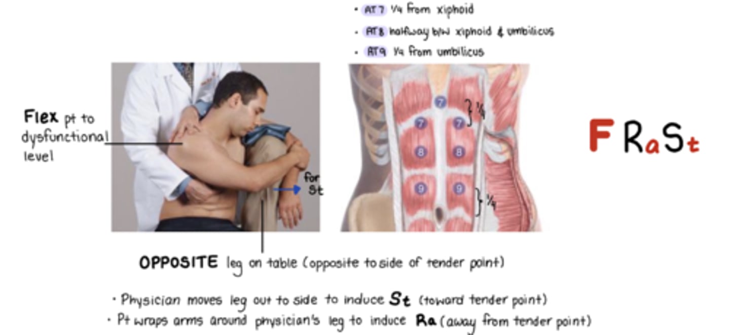 <p>F Ra St</p><p>1/4 from from umbillicus</p><p>St = move leg out to induce pt side bending toward TP</p><p>Ra = pt wraps arm around physicians leg to induce Ra from TP</p>