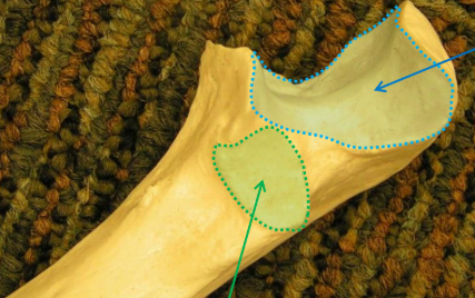 <p>What is the blue area? </p>