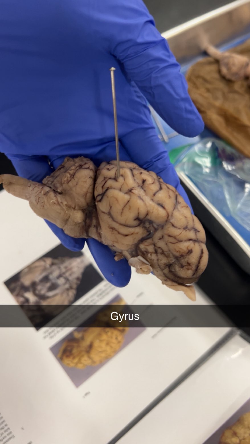 <p>gyrus</p>