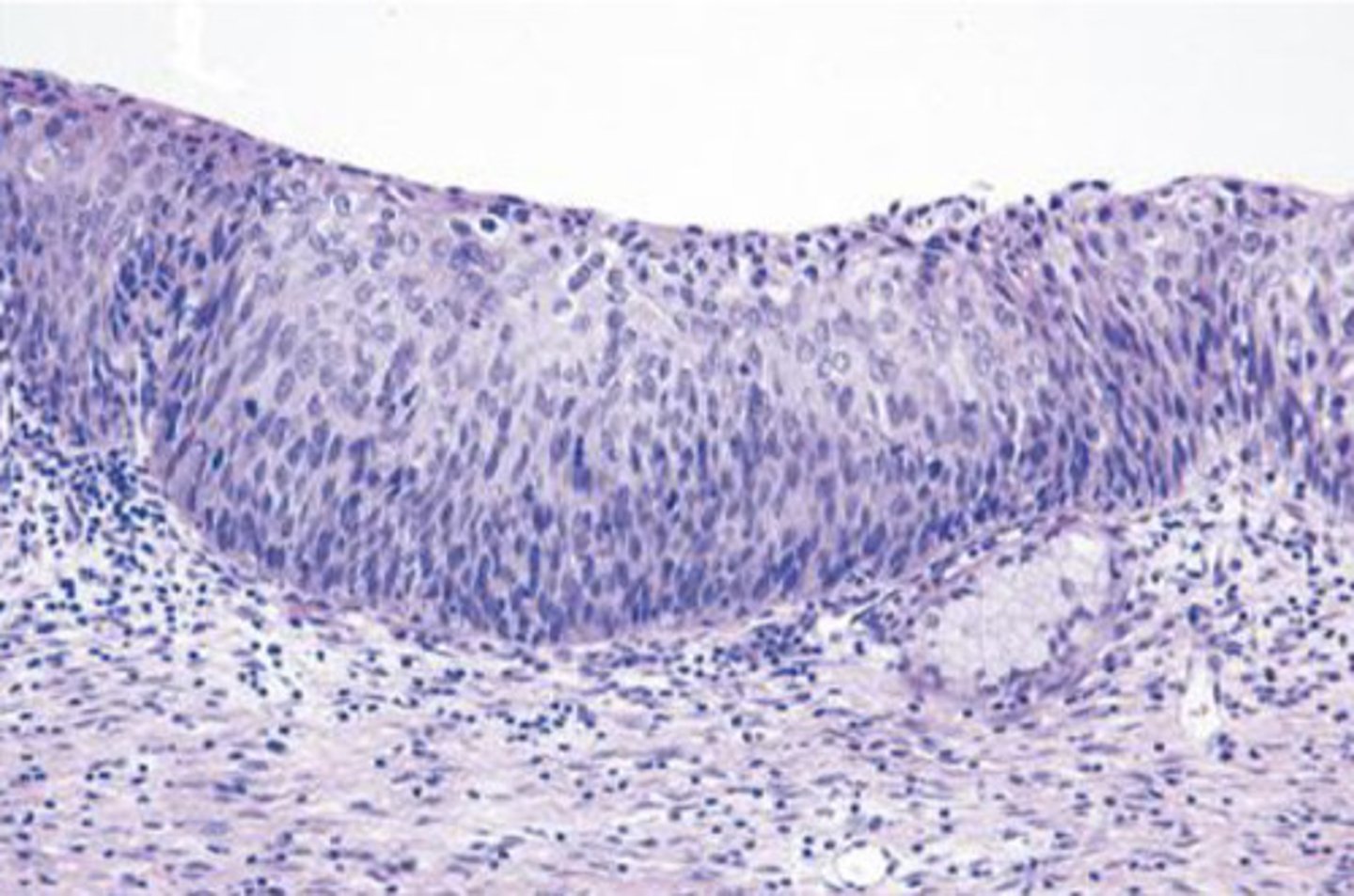 <p>What cellular adaption is occurring in this image?</p>