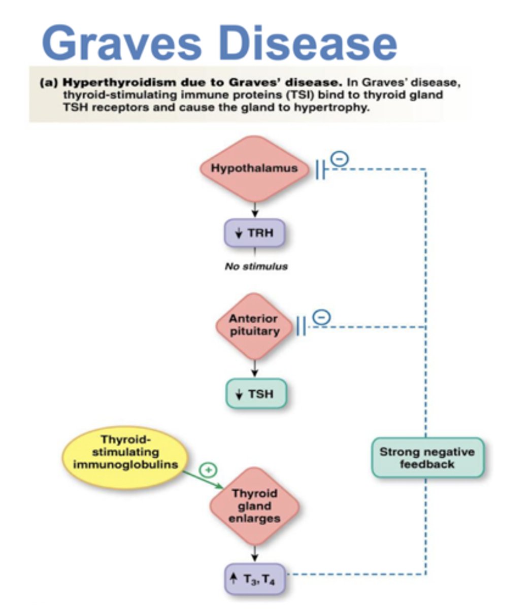 <p>autoimmune disorder in which the body makes abnormal antibodies directed against thyroid follicular cells. they mimic TSH which stimulates TH release. metabolic rate is increased, sweating, rapid and irregular heartbeats, nervousness, weight loss x</p>