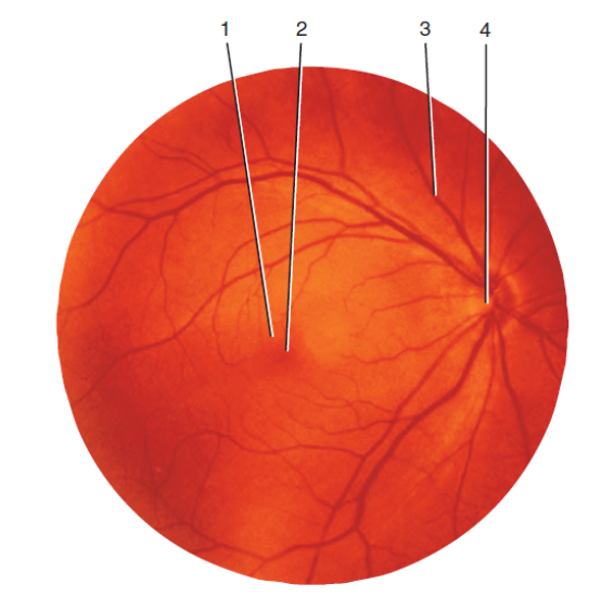 <p>Is this a right eye or left eye? How can you tell?</p>