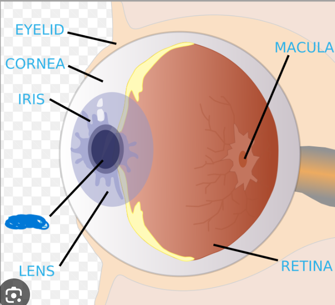 term image