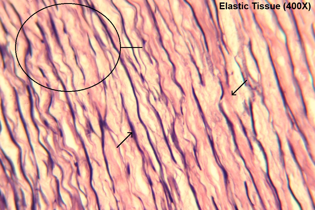 <ul><li><p>Extremely elastic connective tissue proper</p></li><li><p>Present in <strong>nuchal ligament </strong>and<strong> ligamentum flavum</strong></p></li></ul><p></p>