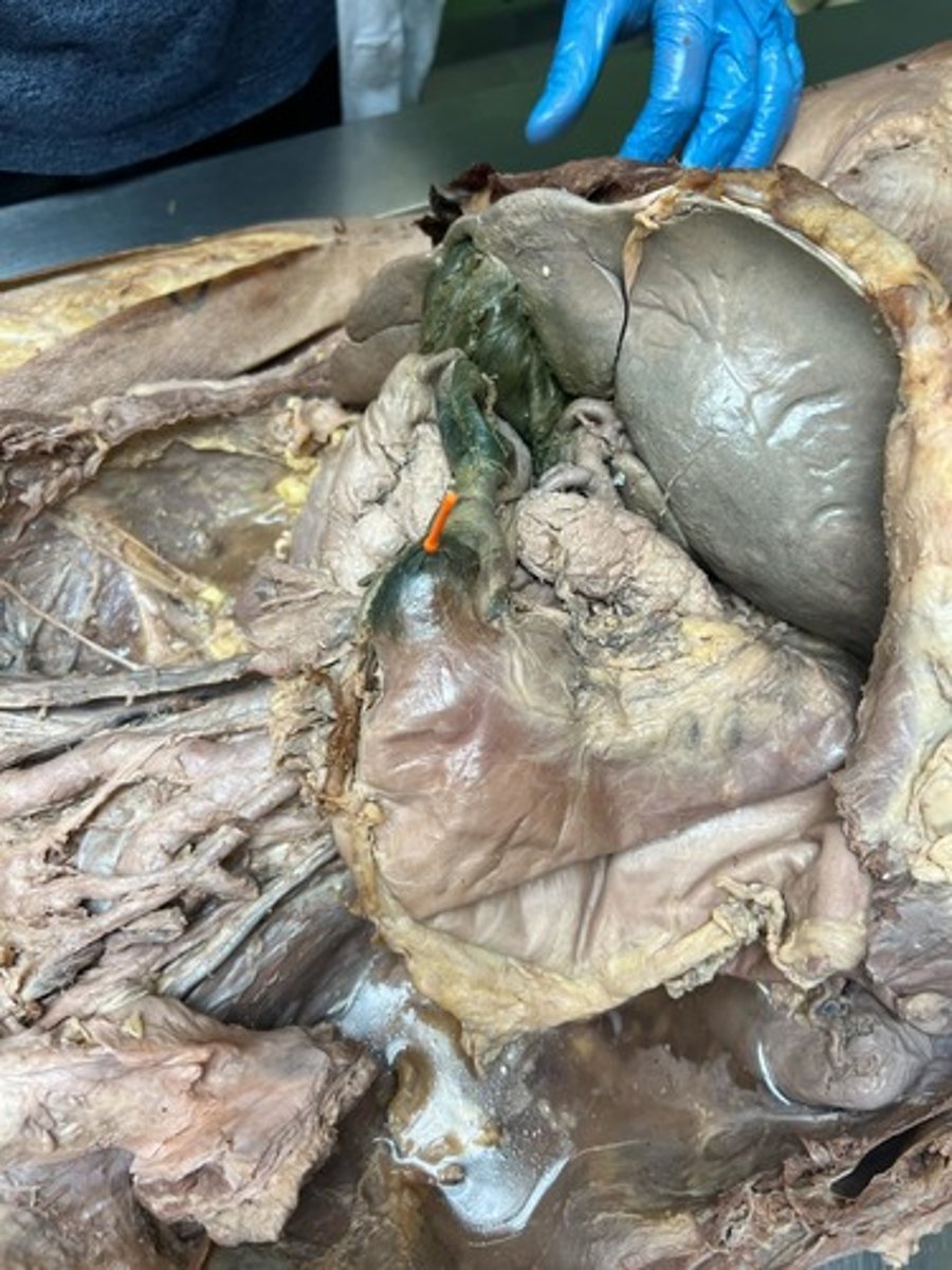 <p>pyrolic part of stomach</p>