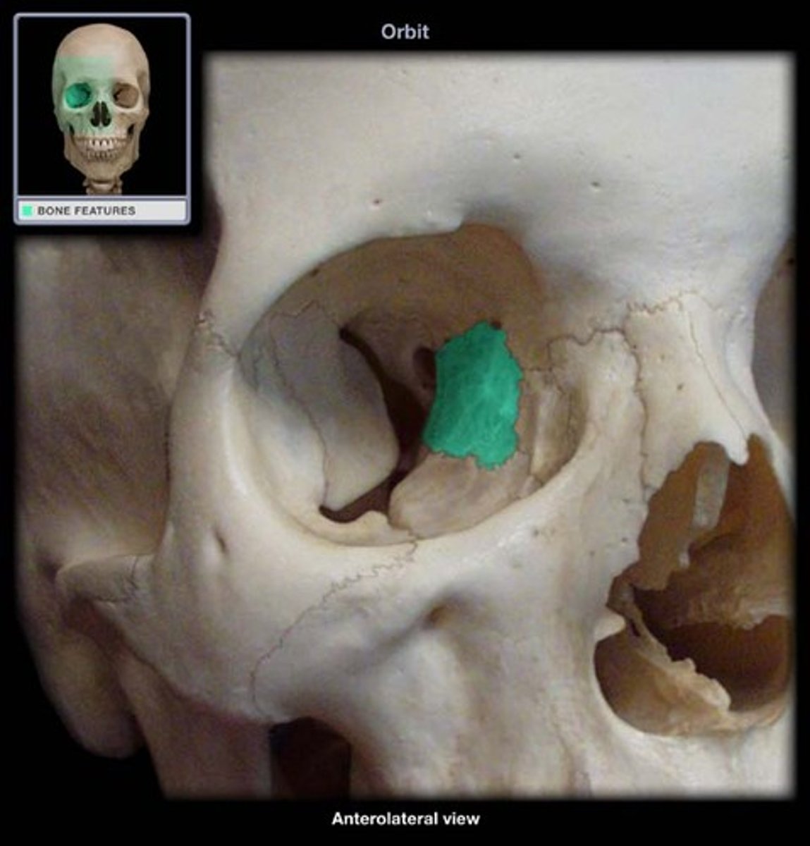 <p>posterior to the lacrimal bone, very thin bone, contributes to medial wall</p>