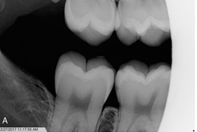 <p>What is the problem with this Cone-cut X-ray?</p>