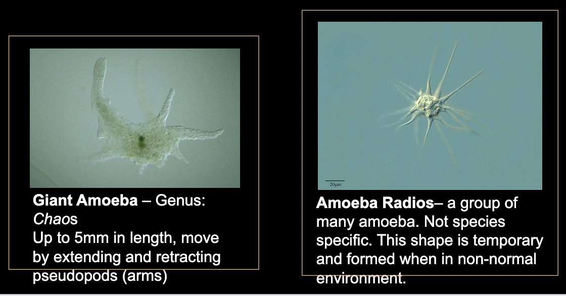 <p>What bacteria is this?</p>
