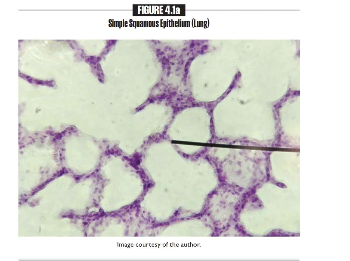 <p>Simple Squamous Epithelium </p>
