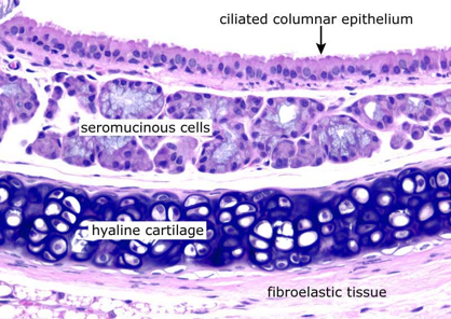 <p>ciliated pseudostratified columnar epithelium</p>