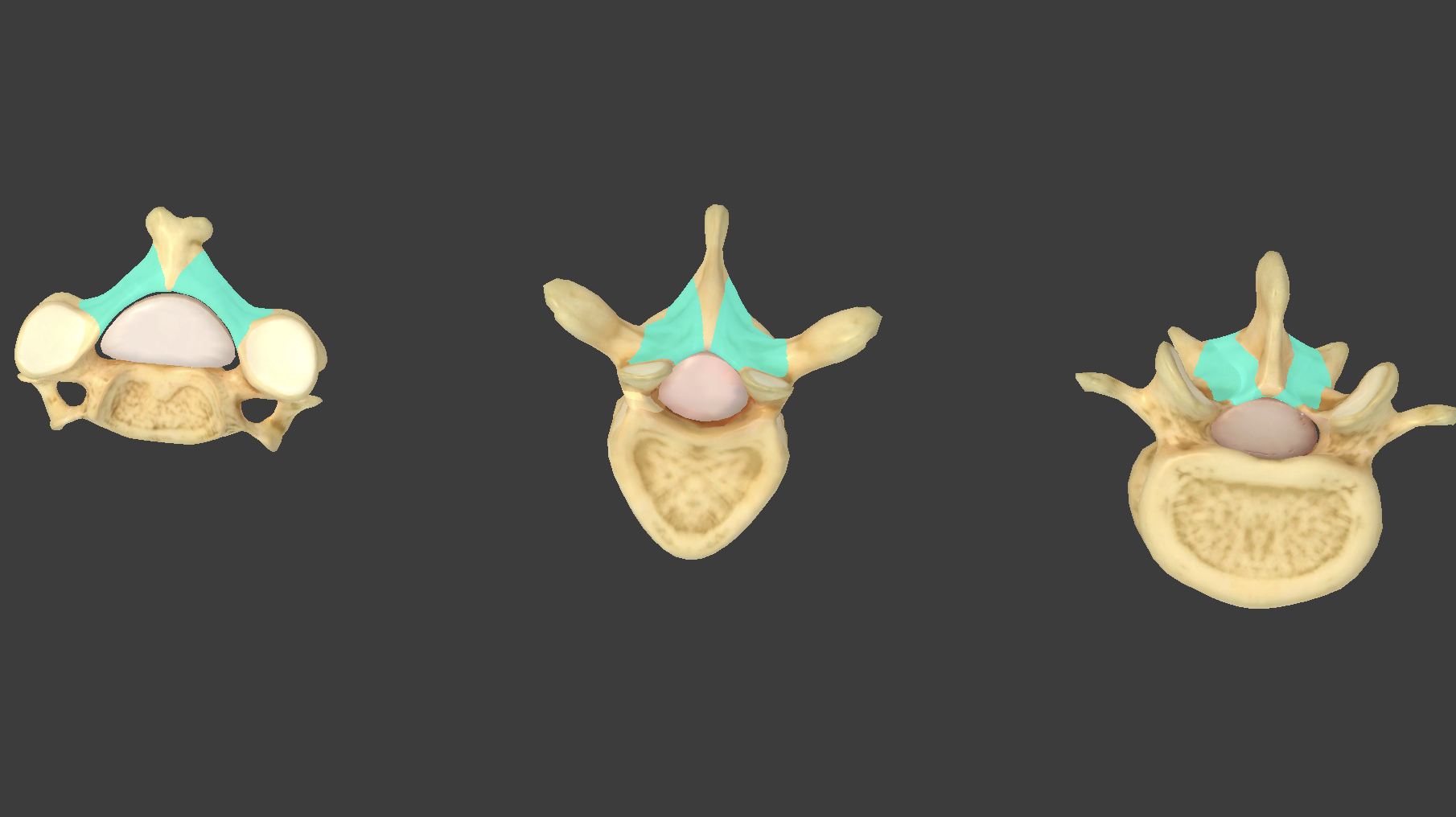 <p>what component of vertebrae is this?</p>