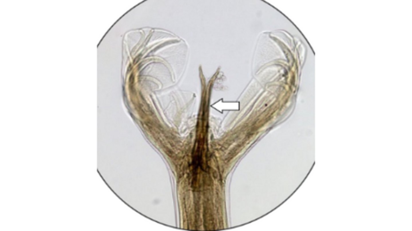 <p>What abomasal, male nematode is this based on its copulatory bursa and spicules (arrow)?</p>