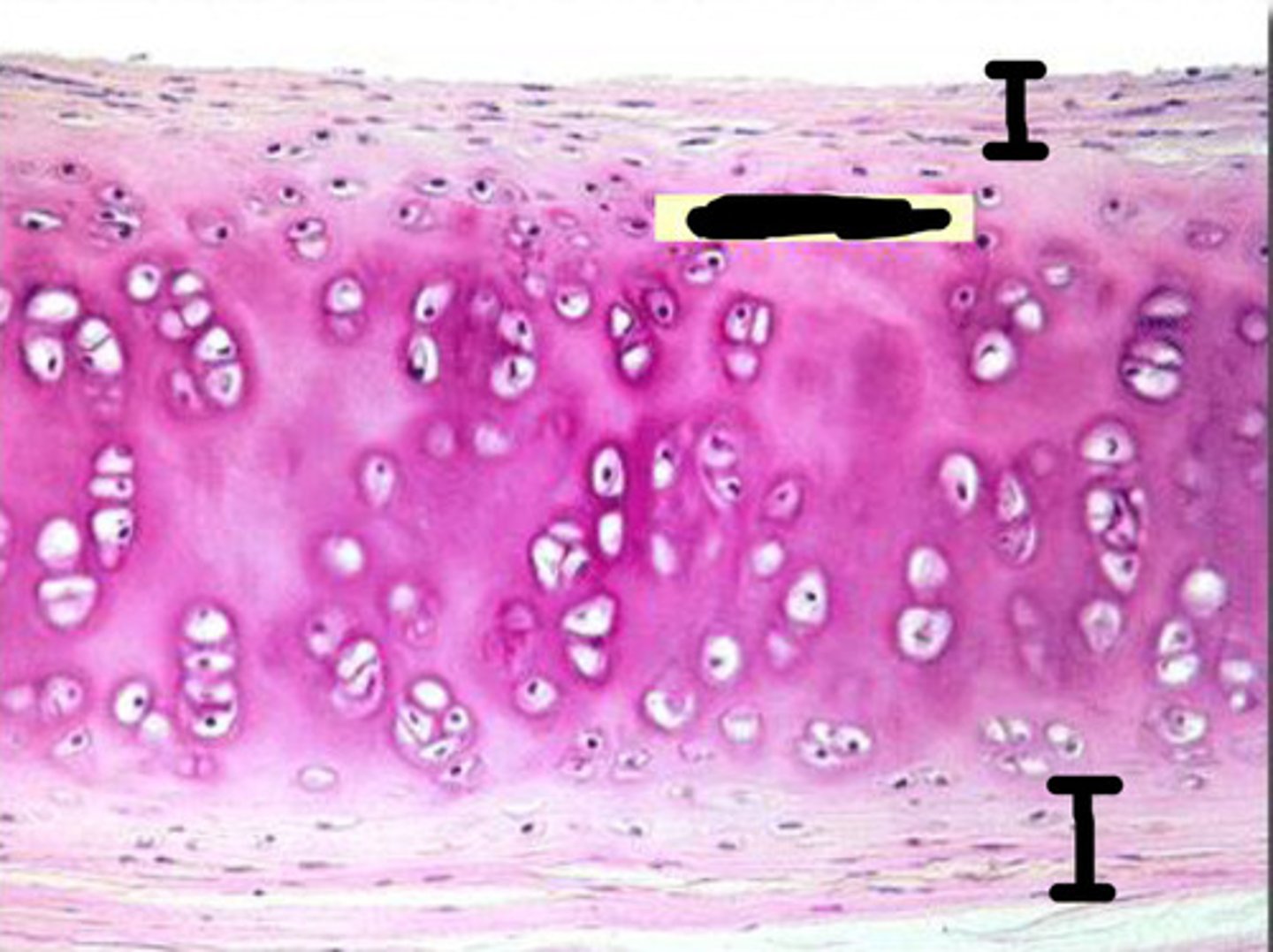 <p>surrounds the cartilage; dense connective tissue girdle; contains blood vessels for nutrient delivery; resists outward expansion</p>