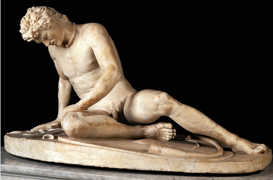 <p>Dying Gaul</p>