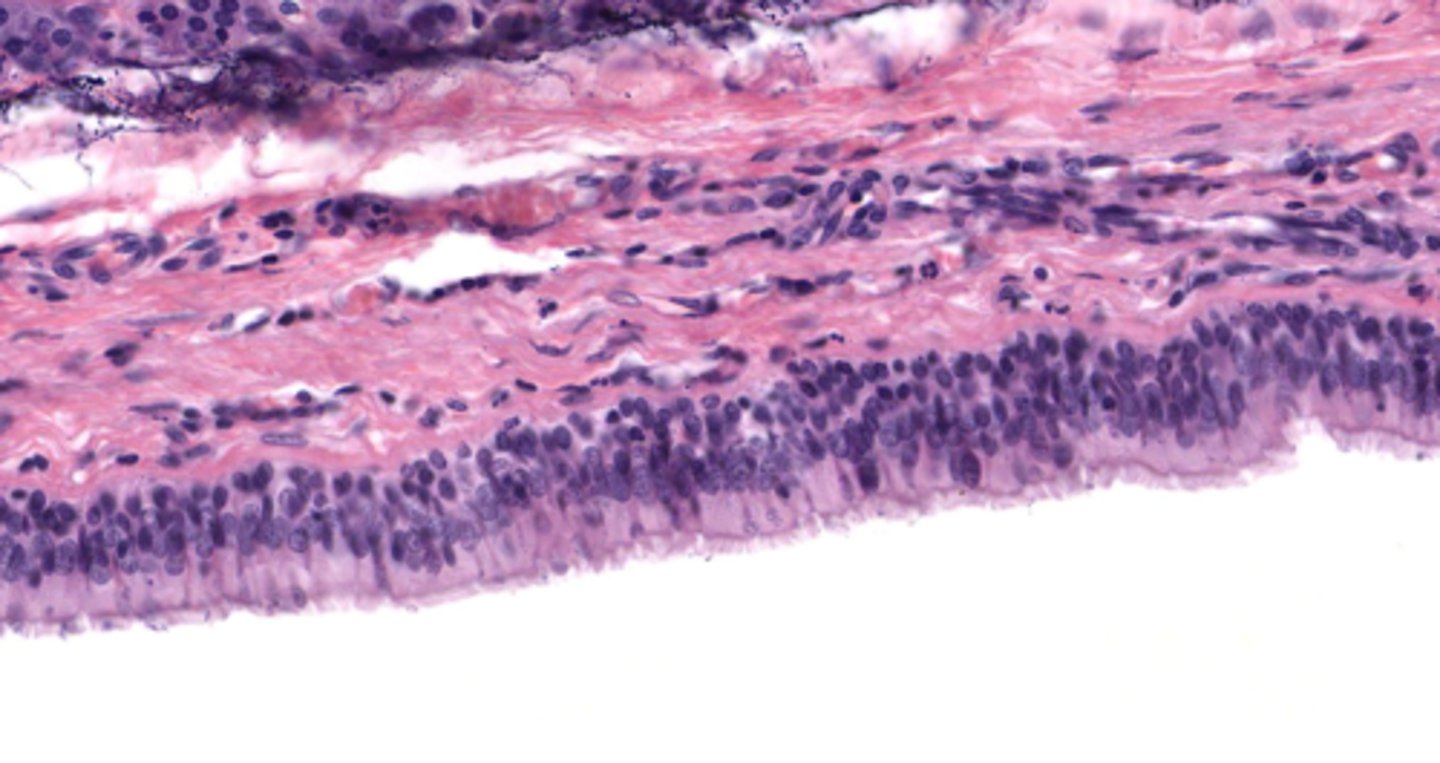 <p>Classify the epithelium of the trachea</p>
