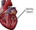 <p>inner surfaces of heart including valves</p>