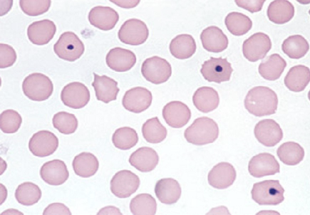 <p>S<u>mall, round, blue-black inclusions</u> that occur <u>singly</u> or doubly in an eccentric position</p><p>Derived form DNA remnants</p>