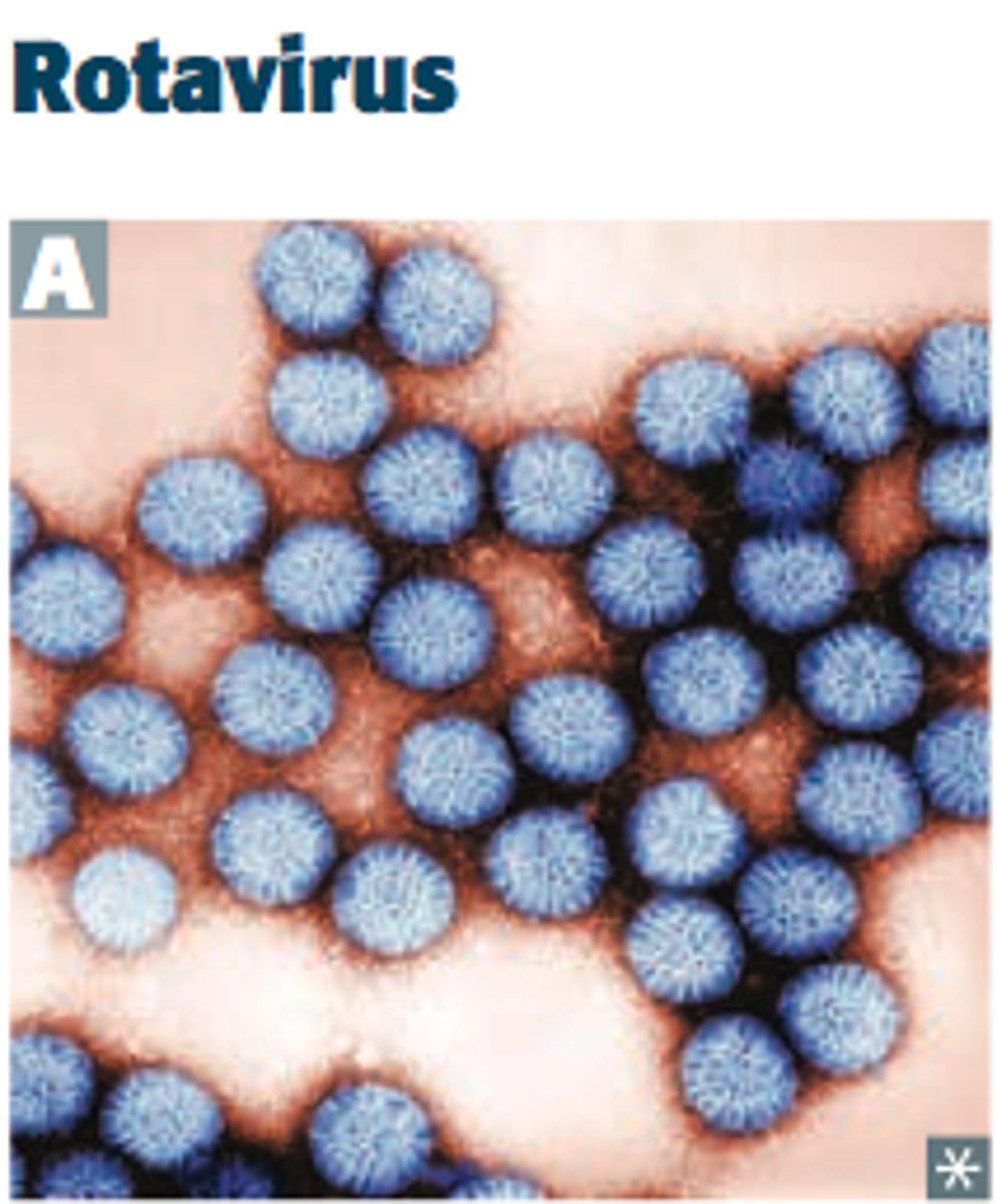 <p>infants and children (~100&amp; by age 5)</p><p>adults in US--&gt; child care workers, elderly, travelers</p><p>Strain A- 90% of infection in humans</p><p>infects/damages mature enterocytes leading to severe malabsorption and loss of disaccharides(2ndary lactose intolerant) - osmotic type diarrhea</p>