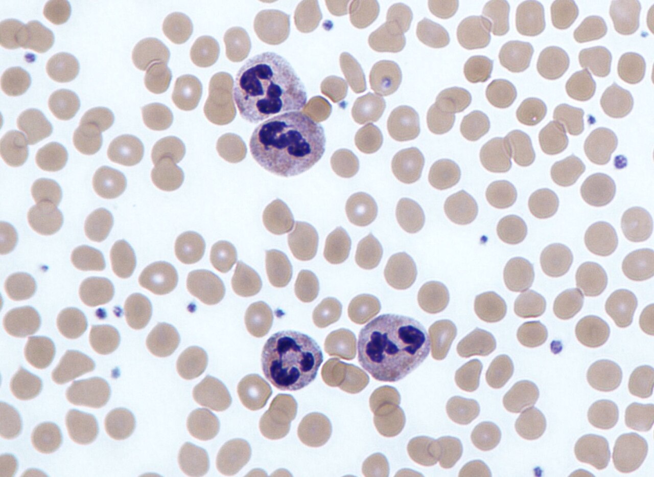<p>which leukocyte is this?</p>