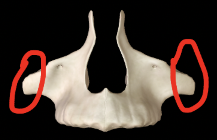 <p>What part of the maxilla is this?</p>