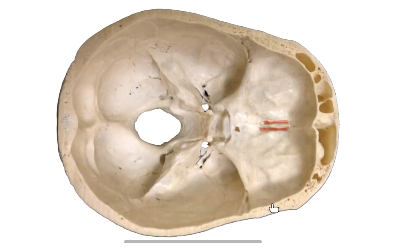 Shadows beside galli 