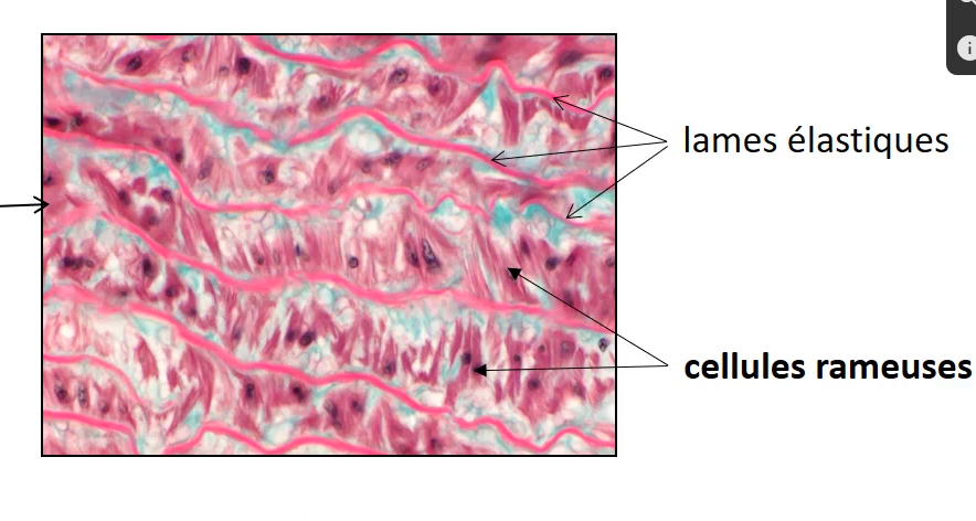 <p>artere elastique</p>